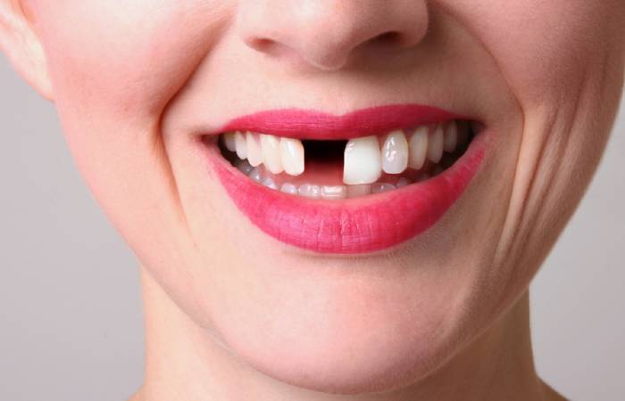 Toothache<br />